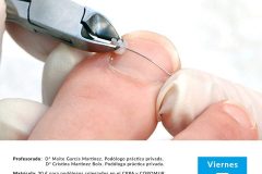 Curso remodelación estética de uñas atrofiadas y ortonixias ungueales Sevilla Mayo 2019