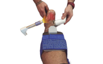 Curso de tratamientos de patologías del pie mediante el Método C.R.I (Capacitivo, Resistivo, Ions-Resonance) y Ondas de Choque