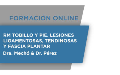 Formación Online: RT Tobillo y Pie. Lesiones Ligamentosas, tendinosas y fascia plantar