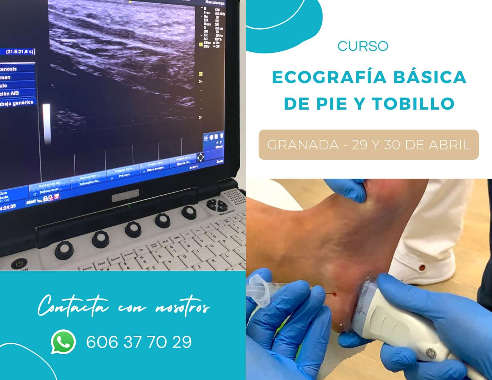 ECOGRAFÍA BÁSICA DE PIE Y TOBILLO