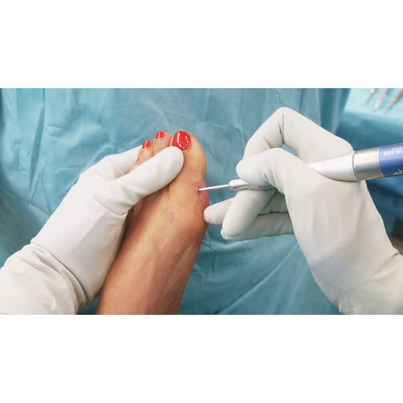 CURSO DE INICIACIÓN A LA CIRUGÍA DE MÍNIMA INCISIÓN. MÁLAGA