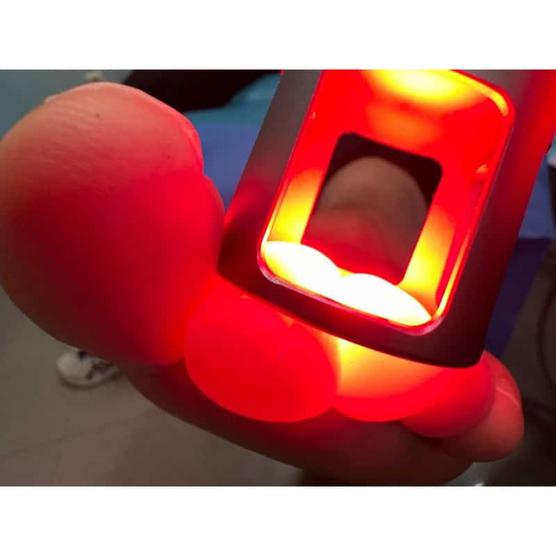 Laserterapia en Podología