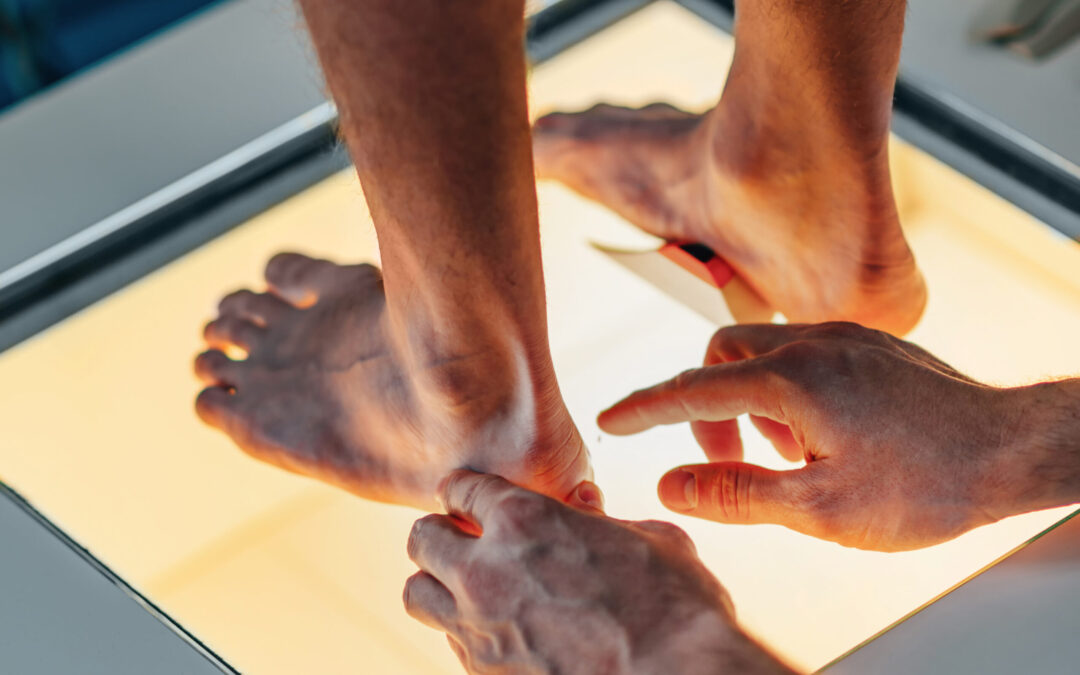 La importancia del estudio de la pisada en deportistas