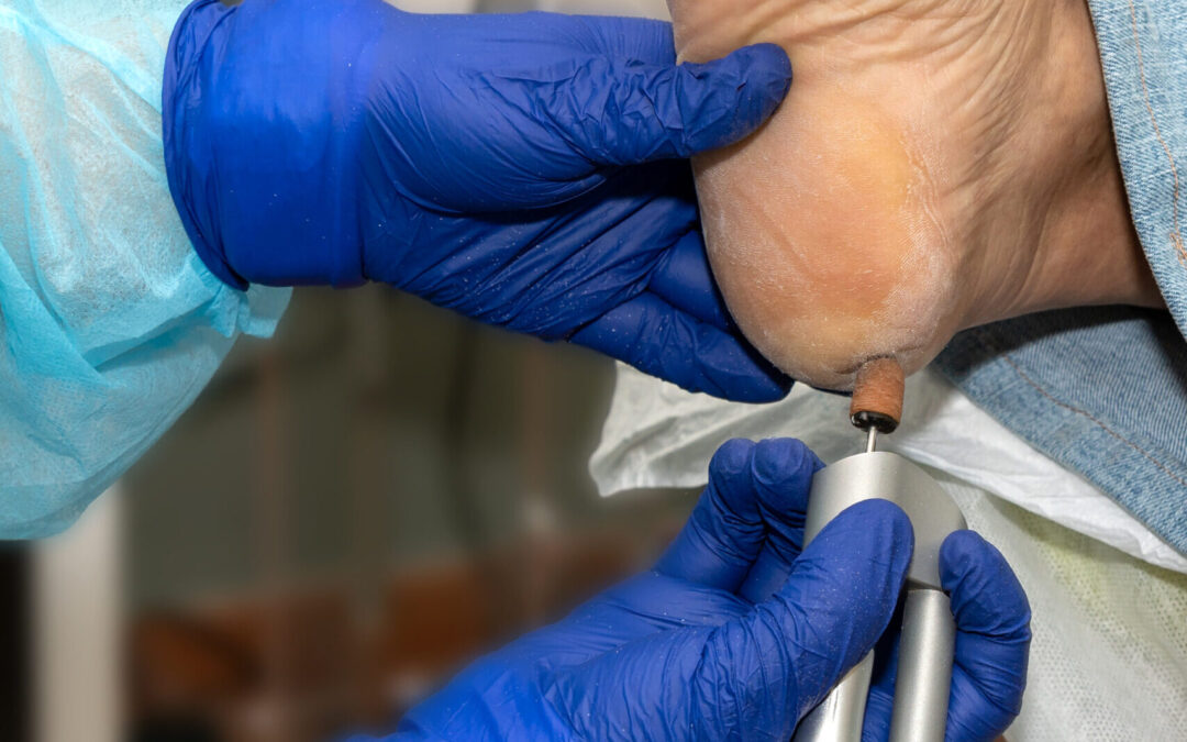 Relación entre la salud del pie y el resto del cuerpo